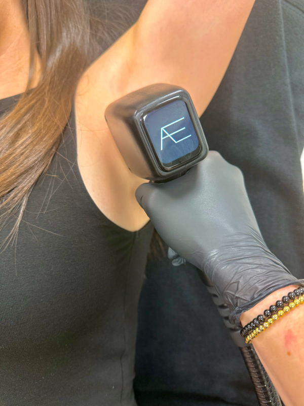 Épilation aisselle femme au laser à Eguilles près d'Aix en Provence Épilation aisselle femme au laser à Eguilles près d'Aix en Provence