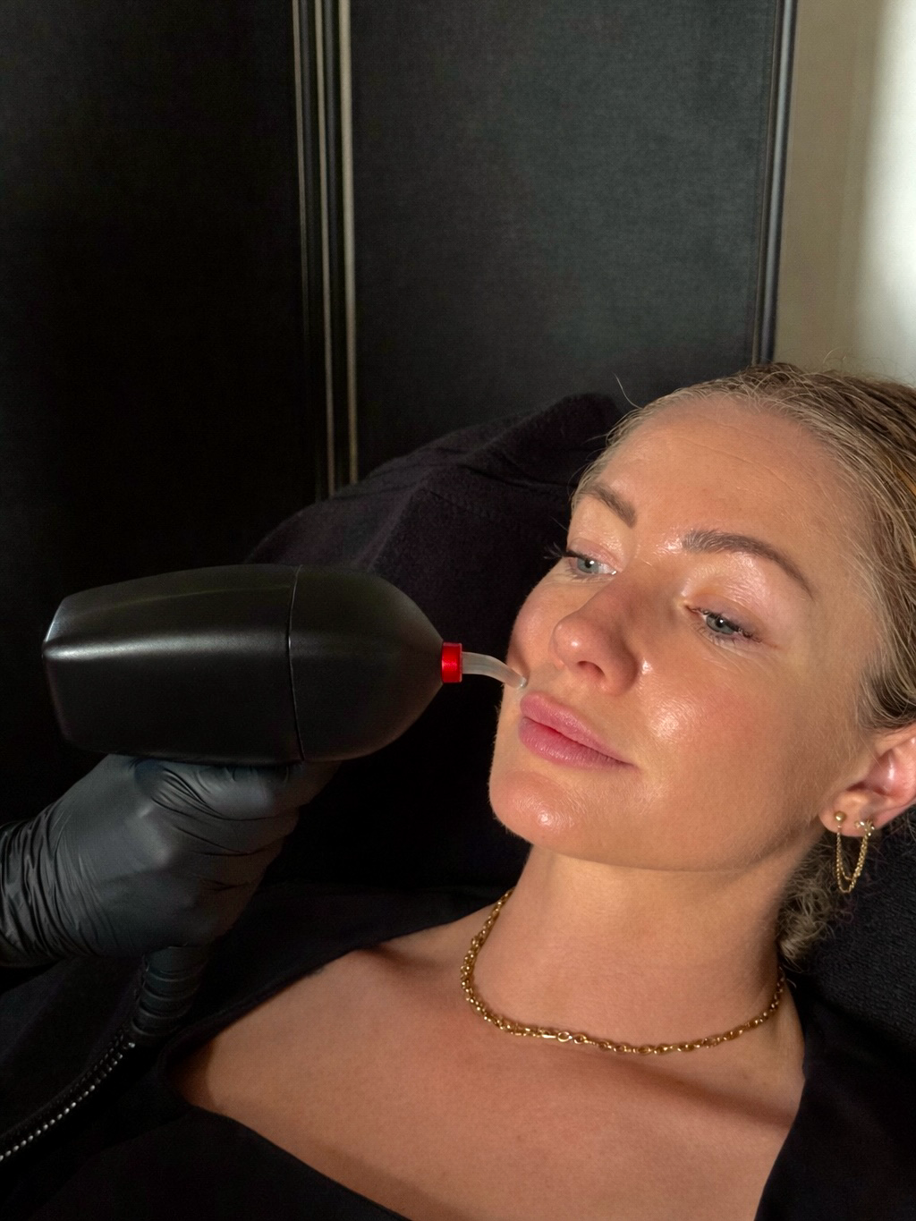 Épilation visage femme au laser Aix en Provence Épilation visage femme au laser Aix en Provence